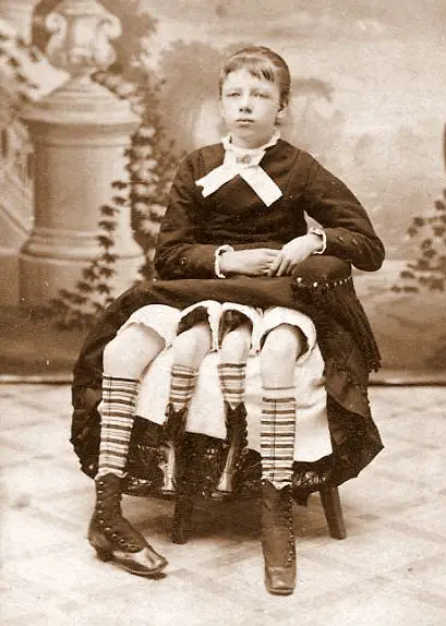 Josephine myrtle corbin, a mulher com 4 pernas
