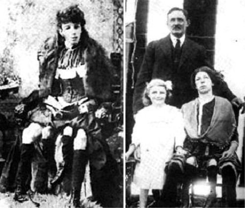 Josephine myrtle corbin, a mulher com 4 pernas e família