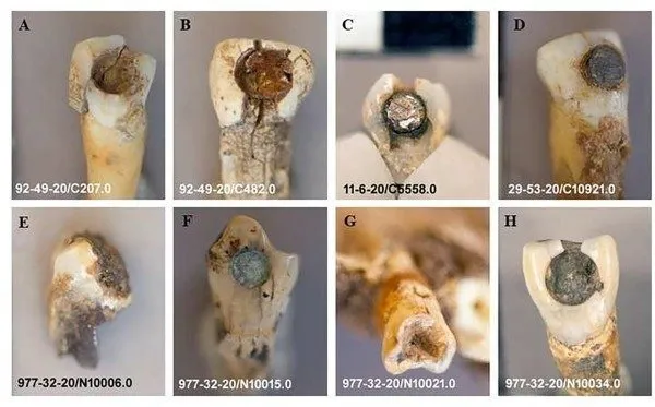 Dentistry teeth • mundo sombrio