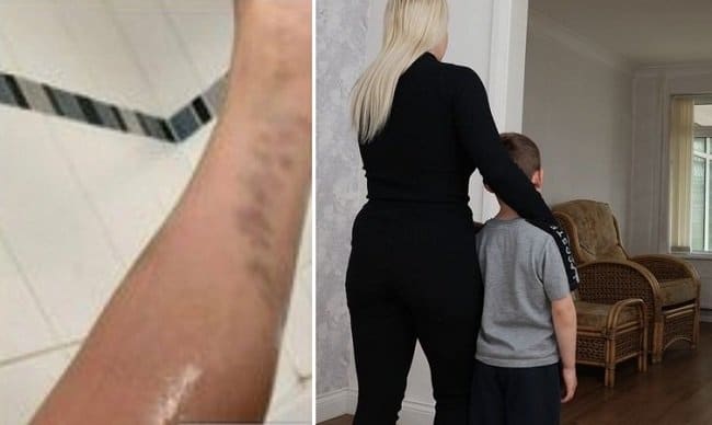 Família inglesa foge de casa por causa dos ataques de um "fantasma sádico" 3 Família inglesa foge de casa por causa dos ataques de um fantasma sádico mundo sombrio