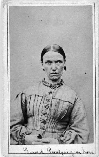 10+ retratos de pacientes psiquiátricos vitorianos que darão arrepio na espinha 22 Eyes • mundo sombrio