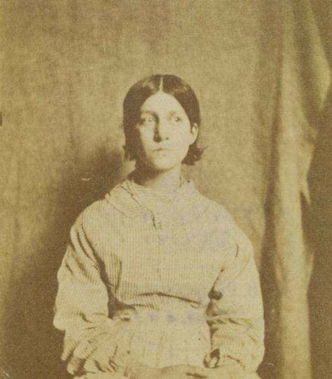 10+ retratos de pacientes psiquiátricos vitorianos que darão arrepio na espinha 21 Looking away from the camera • mundo sombrio