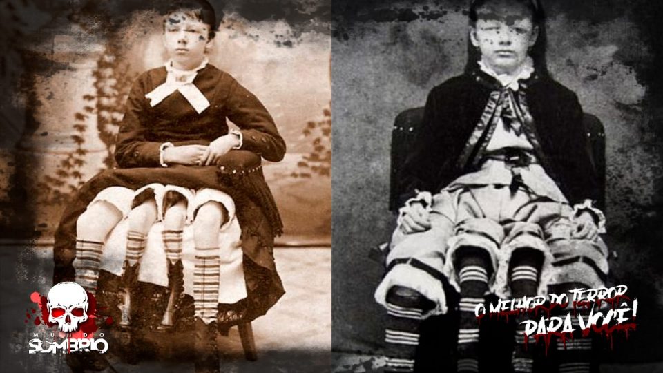 Josephine Myrtle Corbin, a Mulher com 4 Pernas • Mundo Sombrio